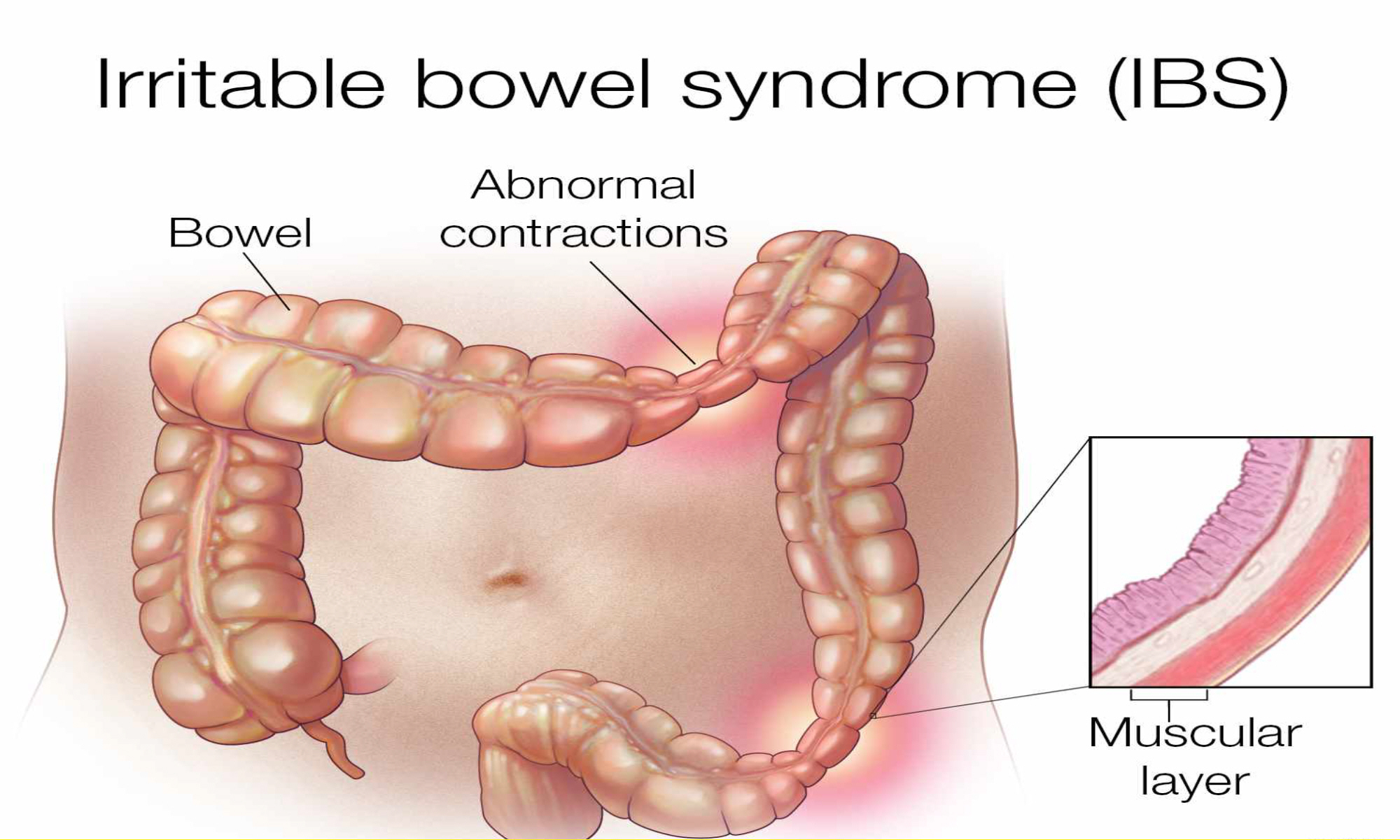 chronic diseases