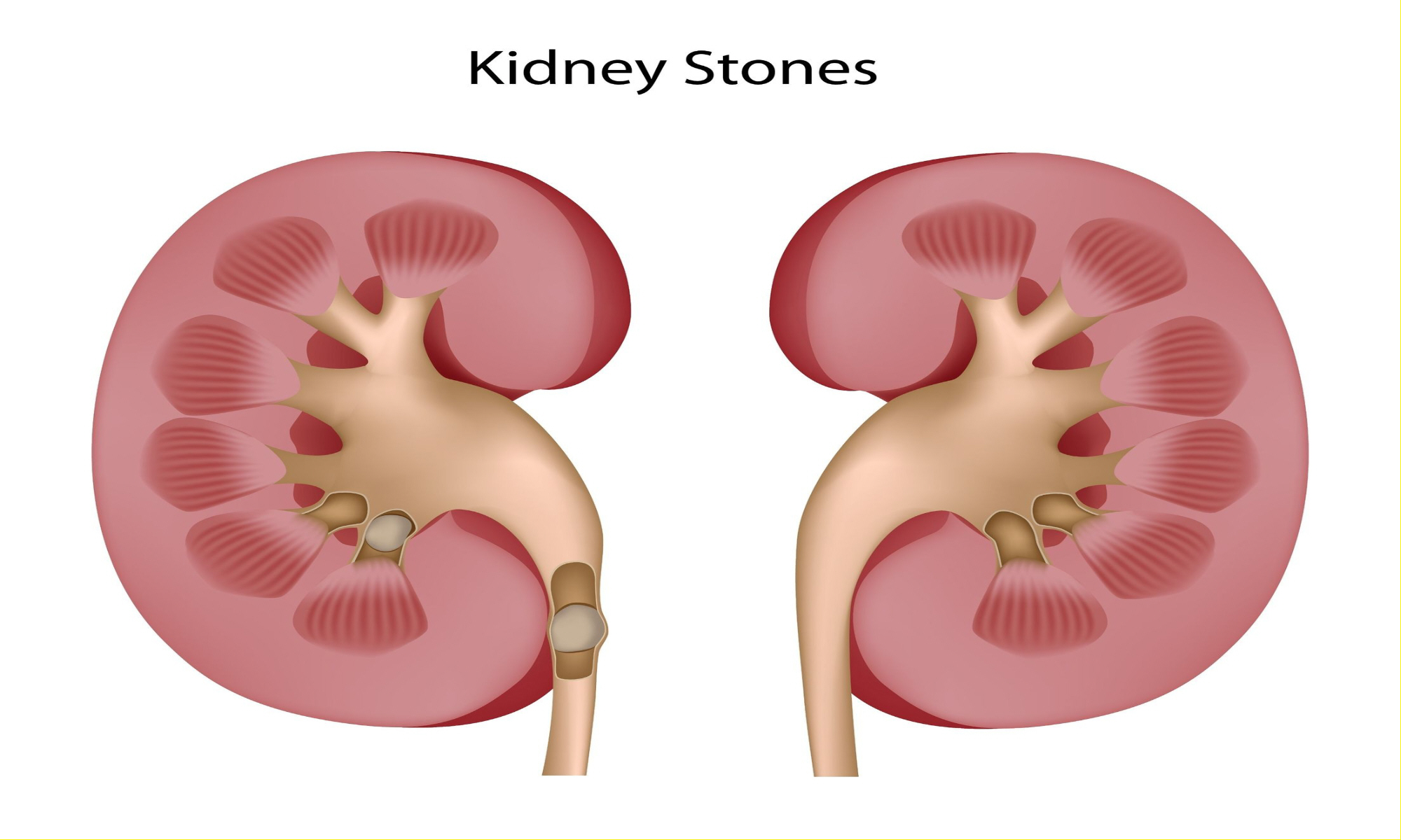 chronic diseases