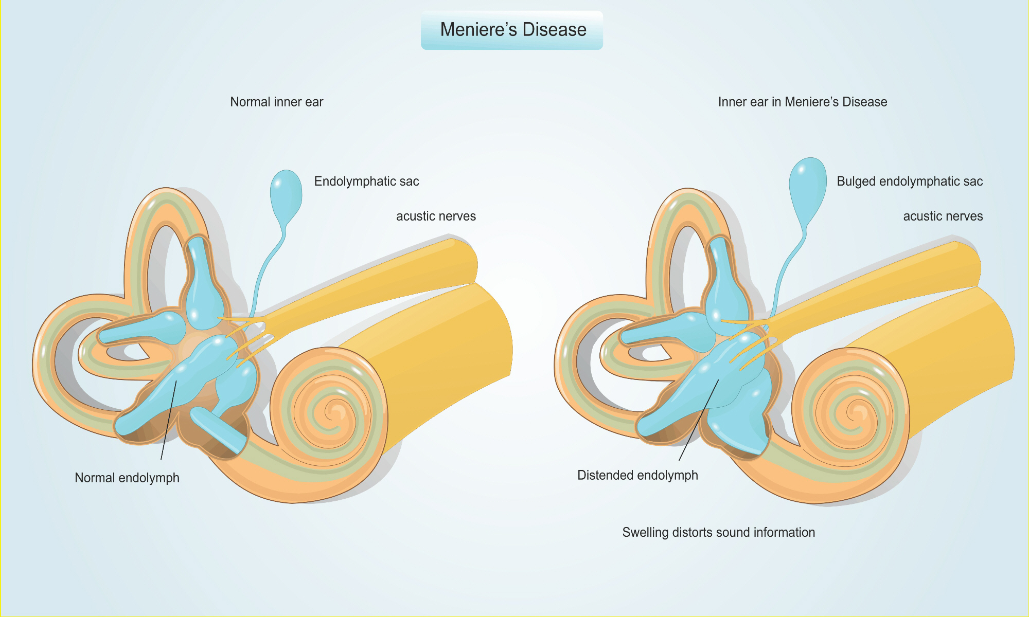 chronic diseases