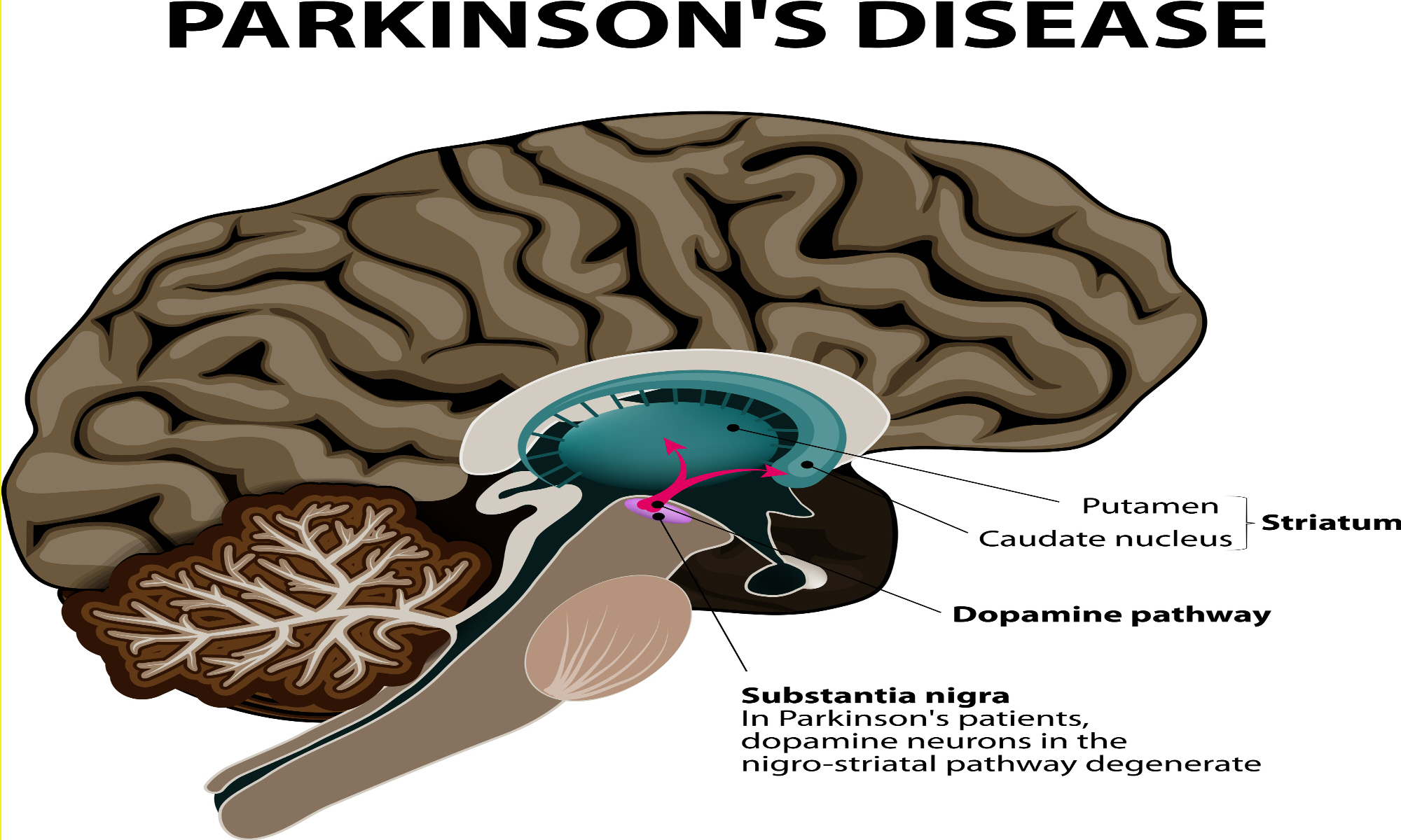 chronic diseases